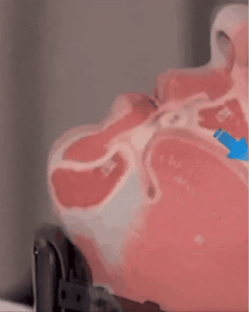 DreamSnore Smart Sleep Aid