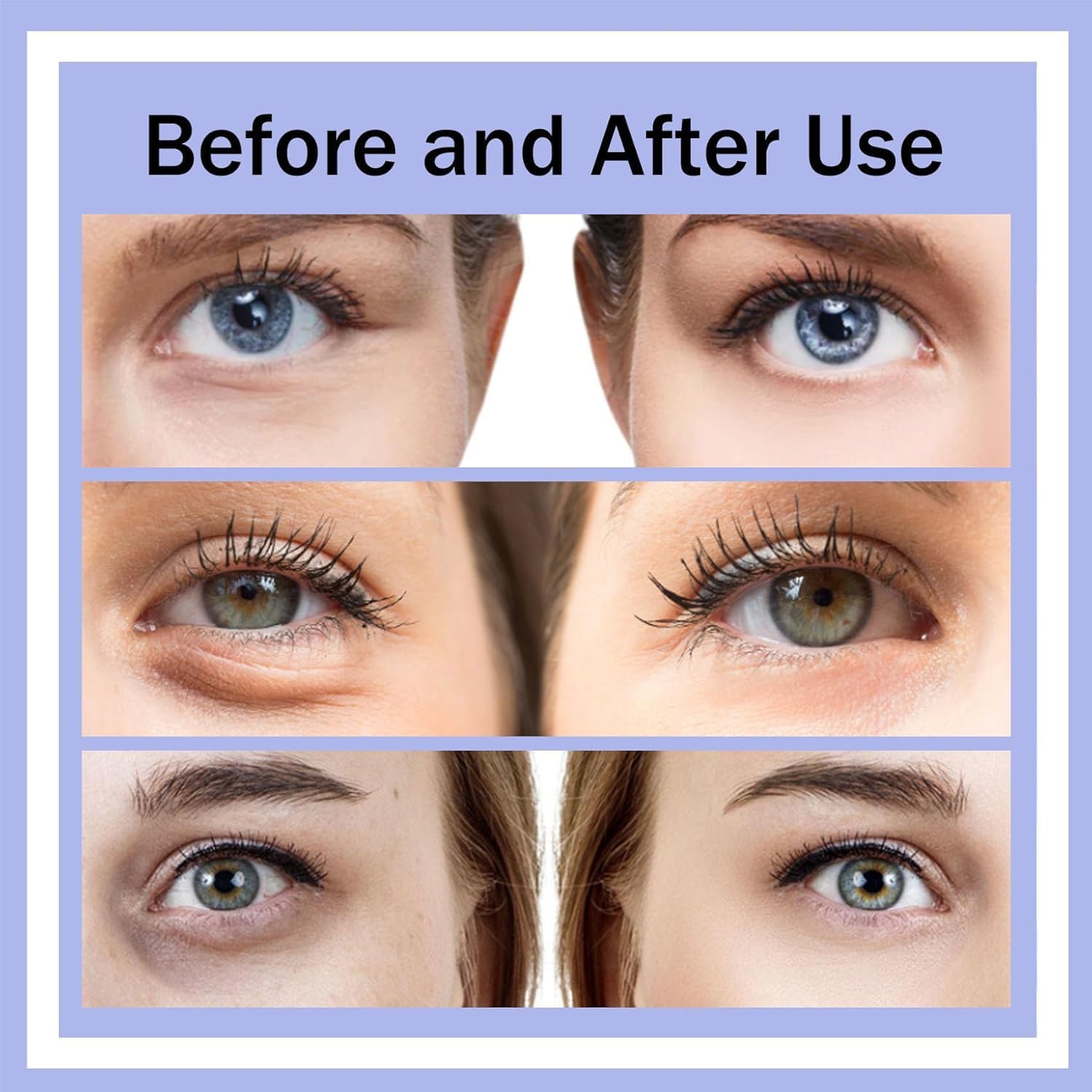 EyeLuméa ;Fade Dark Circles. Firm Fine Lines. Feel the Difference